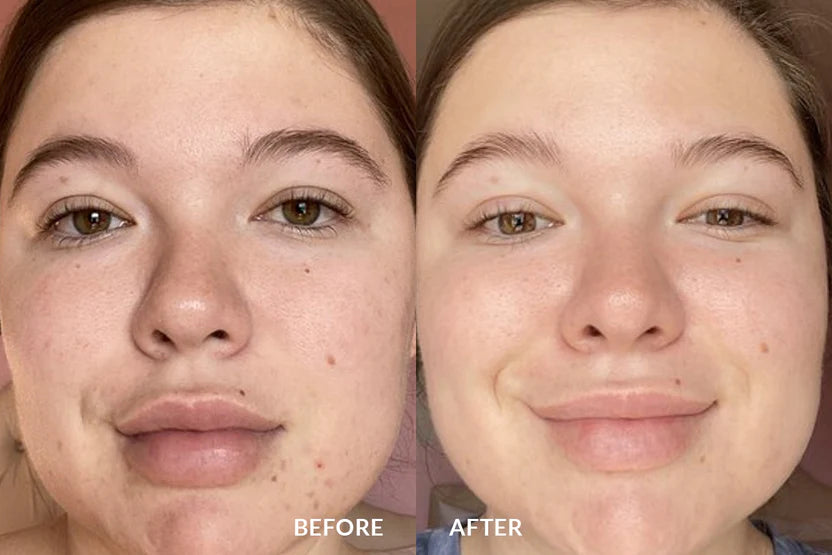Before and after using GlowBrush