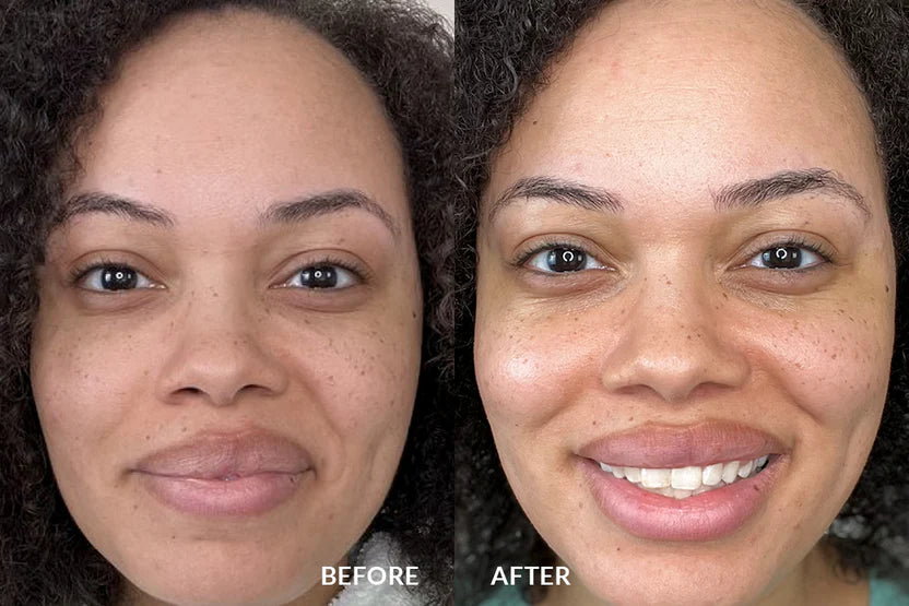 Before and after using GlowBrush