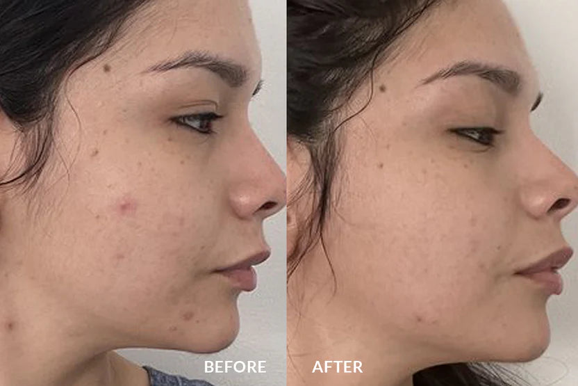 Before and after using GlowBrush