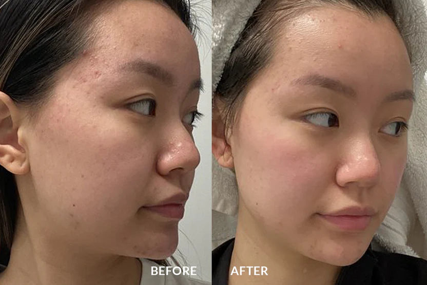 Before and after using GlowBrush