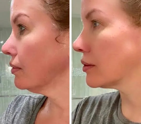 Before and after