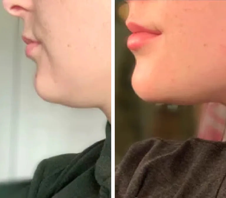 Before and after